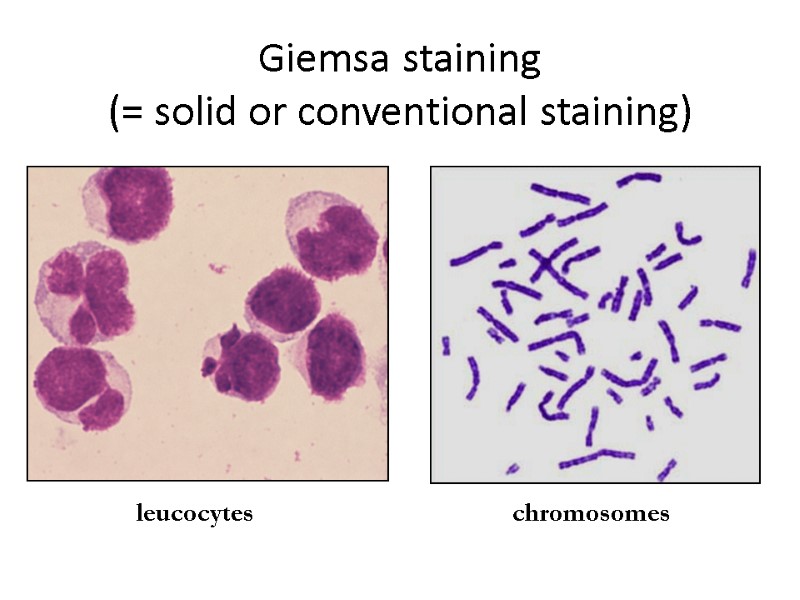 Giemsa staining (= solid or conventional staining) leucocytes chromosomes